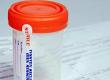 Infertility Treatment